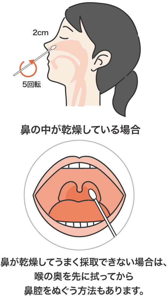 2cm 5回転／鼻の中が乾燥している場合　鼻が乾燥してうまく採取できない場合は、喉の奥を先に拭ってから鼻腔をぬぐう方法もあります。