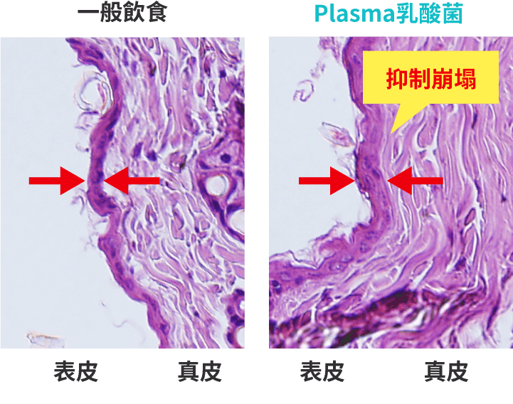 有無攝取Plasma乳酸菌的皮膚崩塌對照圖