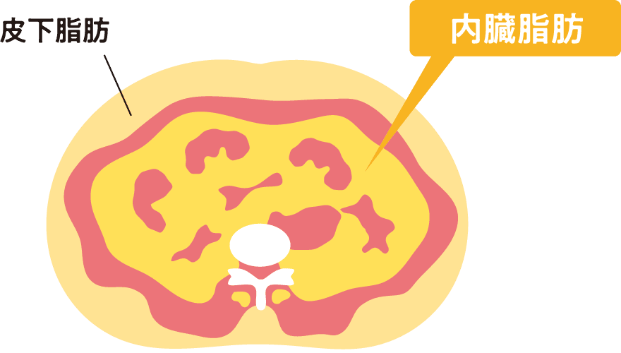 腹部CT（コンピュータ断層撮影）画像 皮下脂肪／内臓脂肪
