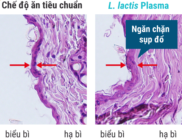 Chế độ ăn tiêu chuẩn / L. lactis Plasma